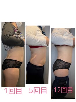 ビオナス(BIONAZ)/わずか1か月半でここまで!