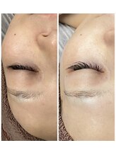 シエル ブルー(Ciel Blue)/肌質改善