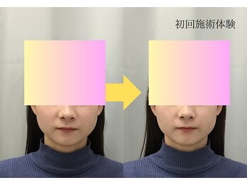 金沢西えみふる整骨院 整体院/小顔/整体/マッサージ/小顔調整