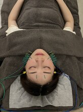 ヴィーライン 大阪梅田院(VeLine)/鍼灸／美容鍼／小顔／大阪／梅田