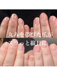 自爪育成/深爪育成/ネイルケア