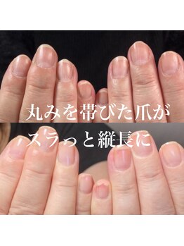 スティラ(Stila)/自爪育成/深爪育成/ネイルケア