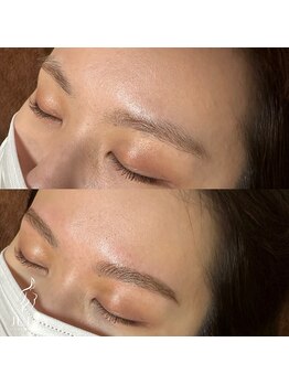 ジュリア(JULIA)/HBL（ハリウッドブロウリフト）