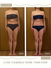 ラナン(Ranan)/BeforeAfter