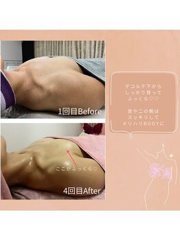 チュラ 大宮店(Chura)/【40代】バストアップ4回目@大宮