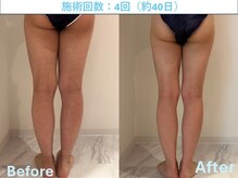 ミッシュ(Mish)/キャビ×リンパマッサージ