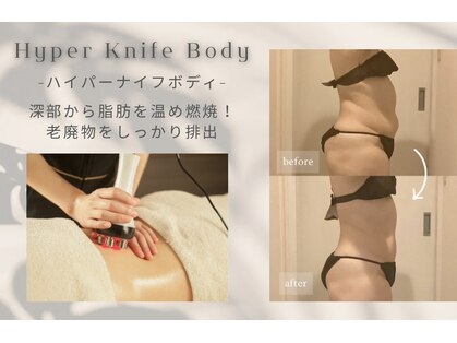 シエル(ciel)の写真