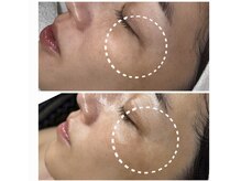 エミレーブ シロカネ(Hemireve Shirokane)/韓国スキンコスメTROIARUKE取扱