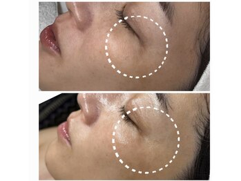 エミレーブ シロカネ(Hemireve Shirokane)/韓国スキンコスメTROIARUKE取扱