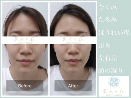 美人ヶ丘の写真