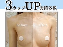 サラエクセレント 梅田(SARA EXCELLENT)の雰囲気（女性専用・完全個室なので安心してバストアップに望めます♪）