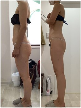 プラチナアース つくば店(Platinum earth)/痩身ビフォーアフター