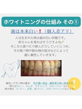 ホワイトニングショップ 福岡姪浜店/ホワイトニングの仕組み