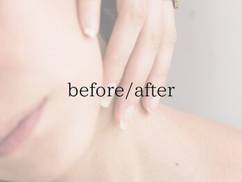 ヨサパーク ふわり/ビフォーアフター