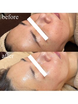 ブレデサガ(B’lady Saga)/一度のサロンケアでの結果です♪