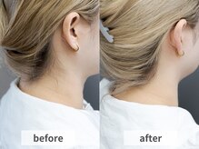 アルムボーテ 代官山 恵比寿(ARUIM Beaute)/シェービングビフォーアフター