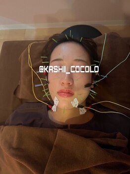 ココロ(CoCoLo)/美容鍼灸