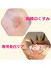 【¥13,200→¥9,900】大人の両頬くすみに対応美白ケア