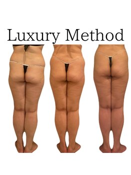 エミナル(EMINALu)/浮腫みの原因は捻れ癒着