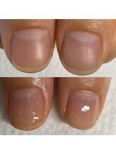 ウェルズユキ(well's yuki)/