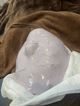 脱毛デビューにオススメのサロン