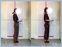 トロ整骨院(toro整骨院)/骨格矯正8回★20代女性