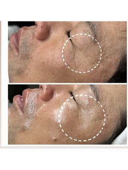 エミレーブ シロカネ(Hemireve Shirokane)/Hemireve Shirokane