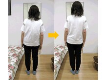 エスコート芦屋サロン/50代　女性　側湾　