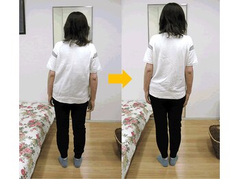 エスコート芦屋サロン/50代 女性 側湾