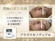 トータルサロンアイビーシー(トータルサロンIBC)の雰囲気（結果重視のフェイシャル◎プラズマで人生史上最高美肌へ！）