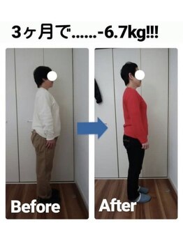 アミージュ(amige)/ビフォーアフター