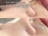 【ご新規様】毛穴洗浄でニキビケア！鎮静・幹細胞導入付き◎8,000円→7,000円