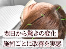 シーキュア 三宮元町(C-cure)の雰囲気（辛い症状を最短最速で改善に導く「頭痛針」）