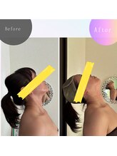 サロン ビールーム(salon 美-room)/首の可動域