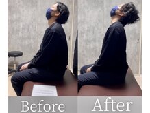 タケダ整体院/首こり・肩こりの改善事例