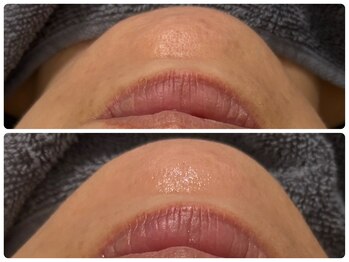 エフェクト 塚口店(effect)/before after