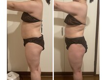 ヨサパーク サンテ 祐天寺(YOSA PARK sante)/痩身/ダイエット/よもぎ蒸し痩身