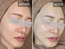 エナ(ENA)の雰囲気（韓国肌管理ララピール。毛穴・くすみ・ごわつきをまとめてケア♪）