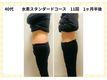 YOSAPARK Luluaの写真/【痩せない原因に集中アタック】進化系よもぎ蒸し×深部リンパマッサージで温活痩身◎理想の美ボディへ