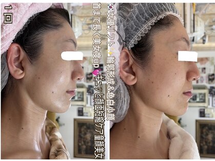 アルページュ(Arpege)の写真