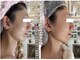 アルページュ(Arpege)の写真