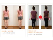J'Sメディカル整体院 栄院の雰囲気(O脚・下半身コースビフォーアフター諦めないで綺麗は作れます!)