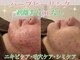 アイル 高槻店(iru)の写真