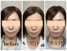 【むくみ】プロの手で一掃！輪郭スッキリ目元パッチリのむくみにくいお顔に☆