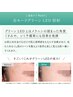 【シミ・黒ずみ予防　透明感】　シミ改善コース（60分）