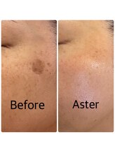 ワールドアイ(World. I)/肌質改善