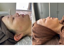 エムアイ 六本木(Mi)/