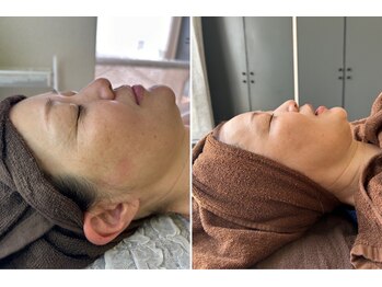 エムアイ 六本木(Mi)/