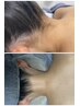 部分パーツ・中高生(襟足～背中) ¥5,500→¥5,000