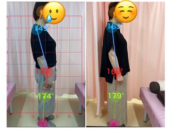 マイティー整骨院 ココア(CoCoa)/姿勢改善